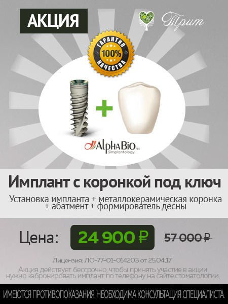 Имплантация зубов Alpha Bio цена