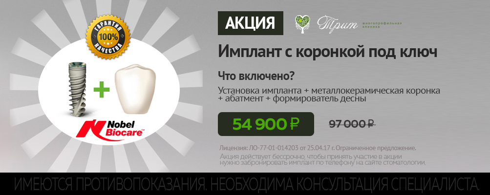 Имплантация зубов Nobel Biocare под ключ