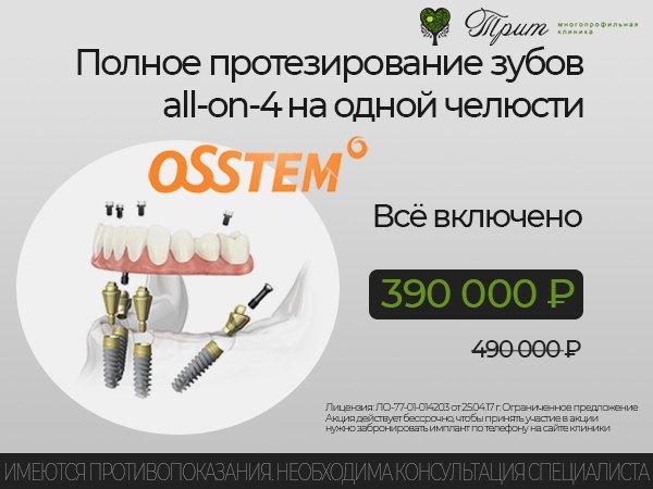Имплантация зубов All-on-4 Osstem цена